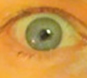 ophthalmologists in sunnyside queens